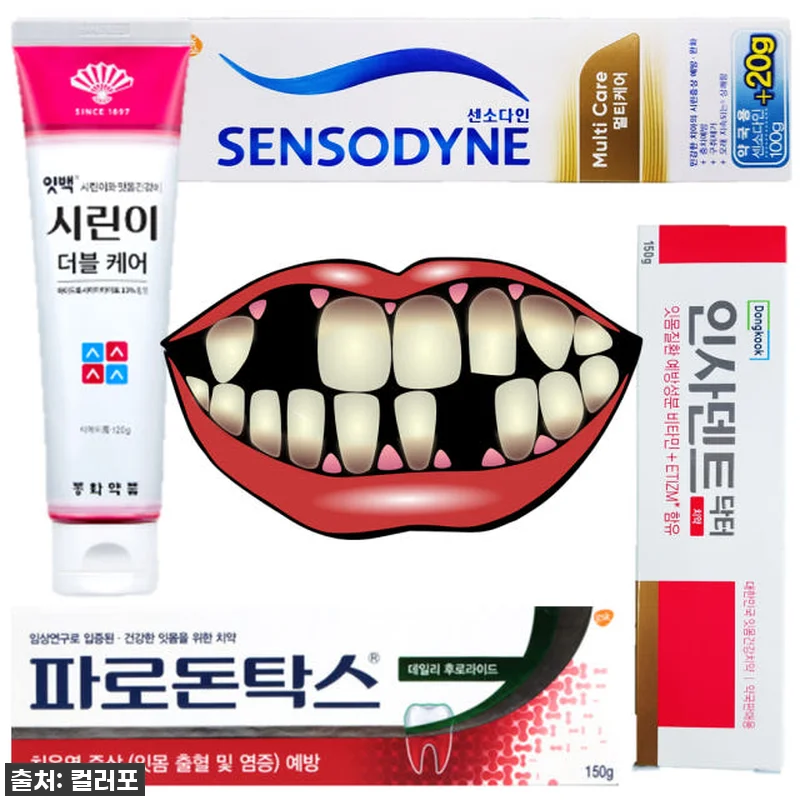 🔥단독공개🔥 시린 이, 잇몸 걱정 끝 관련 이미지 3
