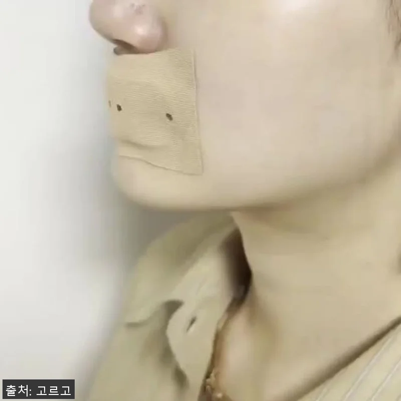 립앤숨 코골이 방지 입벌림 밴드와 입 관련 이미지 6