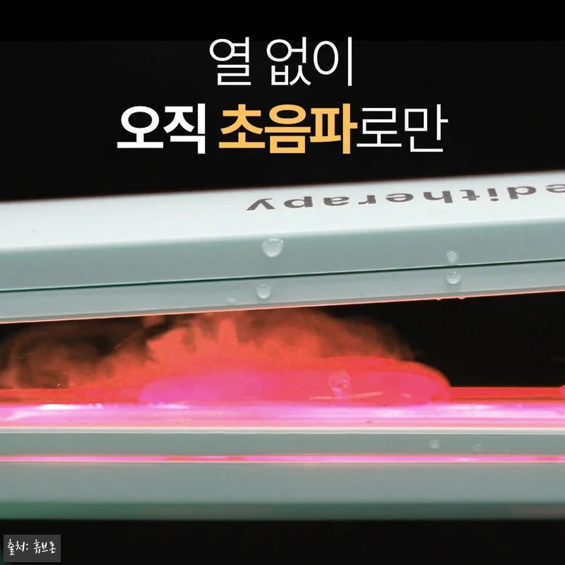 휴브론 헤어케어소닉 초음파고데기, 열 관련 이미지 2